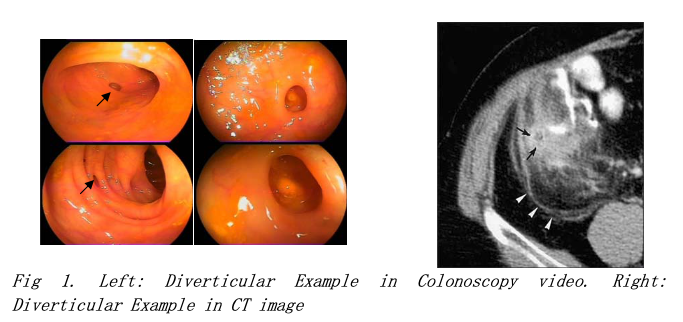 fig1