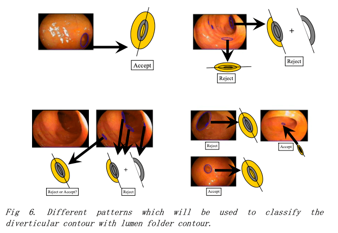 Feature classification patterns and templates
